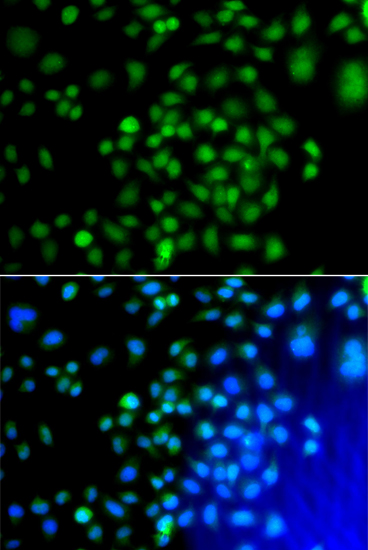 Immunofluorescence - ATF7 Polyclonal Antibody 