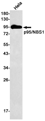 Western blot detection of p95/NBS1 in Hela cell lysates using p95/NBS1 Rabbit mAb(1:500 diluted).Predicted band size:85kDa.Observed band size:95kDa.