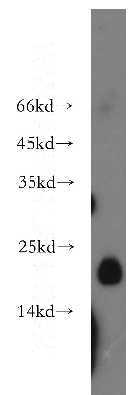 mouse large intestine tissue were subjected to SDS PAGE followed by western blot with Catalog No:109341(CLDN3 antibody) at dilution of 1:300