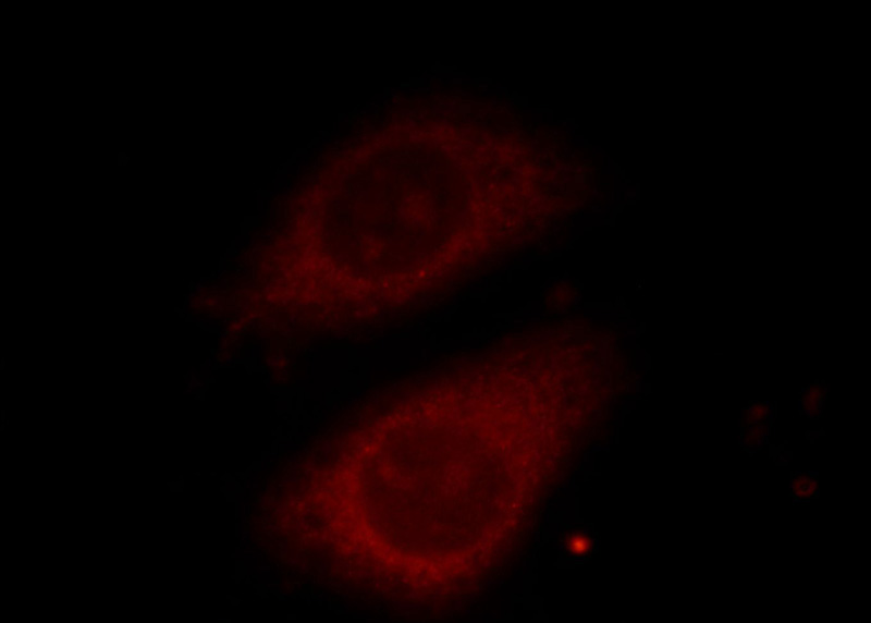 Immunofluorescent analysis of HepG2 cells, using TELO2 antibody Catalog No: at 1:25 dilution and Rhodamine-labeled goat anti-mouse IgG (red).