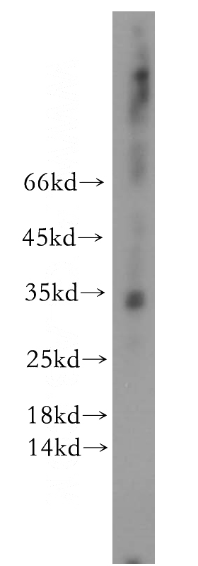 human placenta tissue were subjected to SDS PAGE followed by western blot with Catalog No:107984(ALKBH1 antibody) at dilution of 1:500