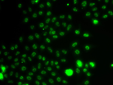 Immunofluorescence - ETV1 Polyclonal Antibody 