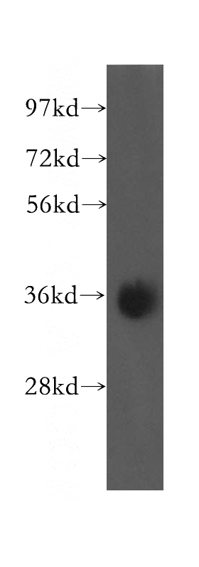 human liver tissue were subjected to SDS PAGE followed by western blot with Catalog No:115800(STX7 antibody) at dilution of 1:500