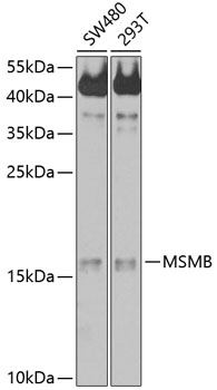 Western blot - MSMB Polyclonal Antibody 