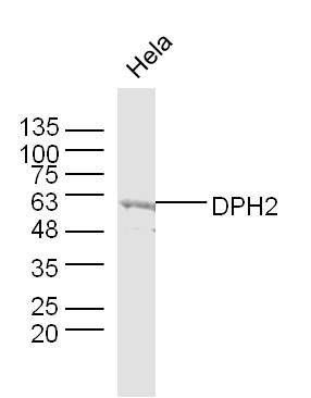 Fig2: Sample: Hela Cell (Human) Lysate at 40 ug; Primary: Anti-DPH2 at 1/300 dilution; Secondary: IRDye800CW Goat Anti-Rabbit IgG at 1/20000 dilution; Predicted band size: 52 kD; Observed band size: 60 kD