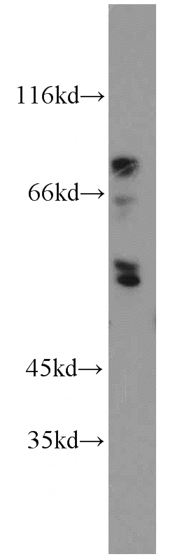 HepG2 cells were subjected to SDS PAGE followed by western blot with Catalog No:110337(ENTPD8 antibody) at dilution of 1:1000