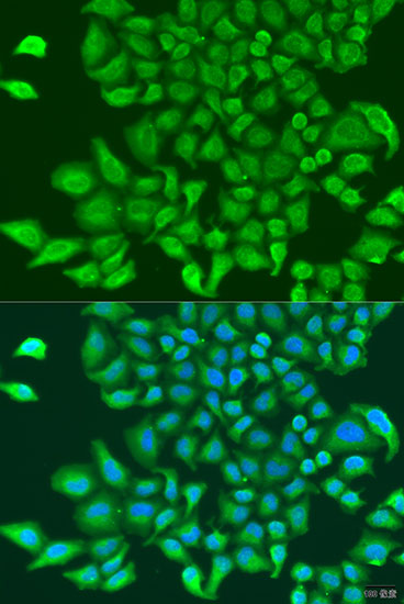 Immunofluorescence - TUBGCP3 Polyclonal Antibody 