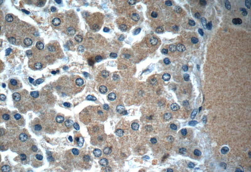 Immunohistochemistry of paraffin-embedded human liver slide using Catalog No:112412(LYRM7 Antibody) at dilution of 1:50 (under 40x lens)
