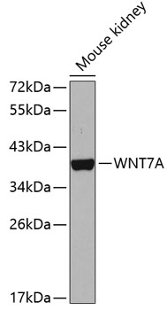 Western blot - WNT7A Polyclonal Antibody 