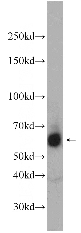 Jurkat cells were subjected to SDS PAGE followed by western blot with Catalog No:114615(RBM46 Antibody) at dilution of 1:1000