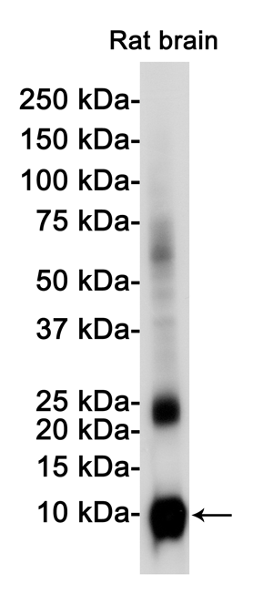 Western blot detection of S100 beta in Rat Brain  lysates using S100 beta Rabbit pAb(1:1000 diluted).Predicted band size:11KDa.Observed band size:11KDa.