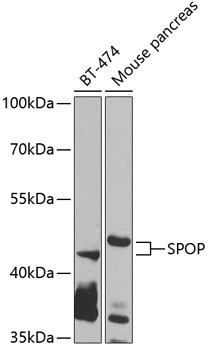 Western blot - SPOP Polyclonal Antibody 