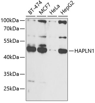 Western blot - HAPLN1 Polyclonal Antibody 