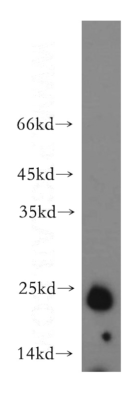 human skeletal muscle tissue were subjected to SDS PAGE followed by western blot with Catalog No:111700(HSP27 antibody) at dilution of 1:300