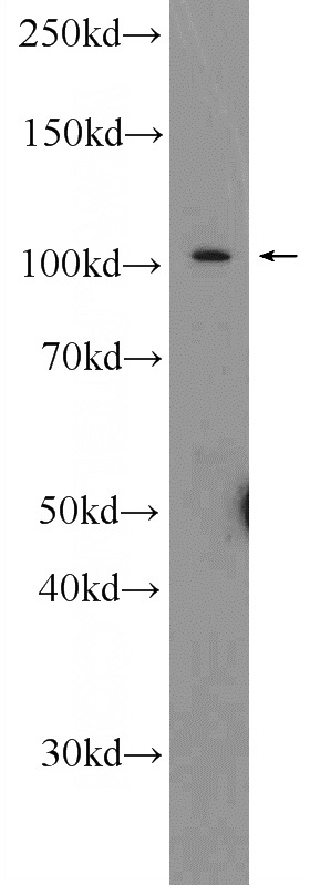 mouse lung tissue were subjected to SDS PAGE followed by western blot with Catalog No:111830(IREB2 Antibody) at dilution of 1:300