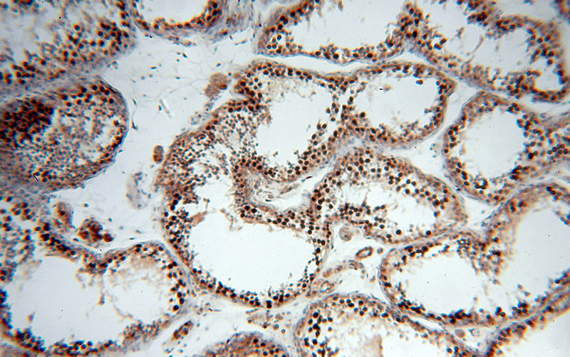 Immunohistochemical of paraffin-embedded human testis using Catalog No:110518(FANCD2-phospho antibody) at dilution of 1:50 (under 10x lens)