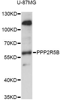 Western blot - PPP2R5B Polyclonal Antibody 