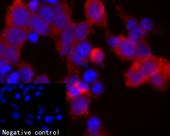 Fig2:; ICC staining of Zfp352 in Non-transfected 293T cells and GFP-tagged Zfp352 transfected 293T cells (red). Formalin fixed cells were permeabilized with 0.1% Triton X-100 in TBS for 10 minutes at room temperature and blocked with 1% Blocker BSA for 15 minutes at room temperature. Cells were probed with the primary antibody ( 1/50) for 1 hour at room temperature, washed with PBS. Alexa Fluor®594 Goat anti-Rabbit IgG was used as the secondary antibody at 1/100 dilution. The nuclear counter stain is DAPI (blue).