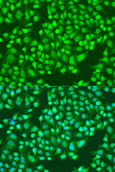 Immunofluorescence - ITGA2 Polyclonal Antibody 