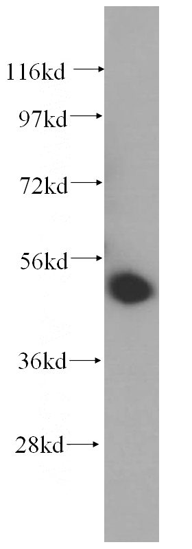 HeLa cells were subjected to SDS PAGE followed by western blot with Catalog No:116570(UMPS antibody) at dilution of 1:400