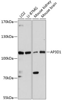 Western blot - AP3D1 Polyclonal Antibody 