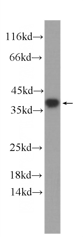 HeLa cells were subjected to SDS PAGE followed by western blot with Catalog No:107652(U2AF35 Antibody) at dilution of 1:1000