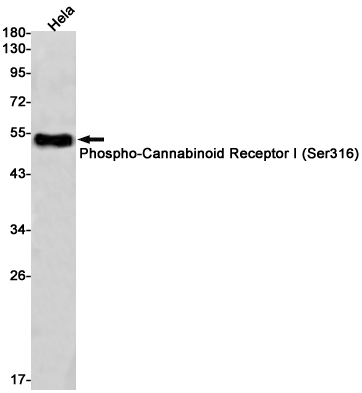 Western blot detection of Phospho-Cannabinoid Receptor I (Ser316) in Hela cell lysates using Phospho-Cannabinoid Receptor I (Ser316) Rabbit pAb(1:1000 diluted).Predicted band size:53kDa.Observed band size:53kDa.