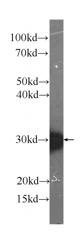 K-562 cells were subjected to SDS PAGE followed by western blot with Catalog No:107482(PRDX4 Antibody) at dilution of 1:1000