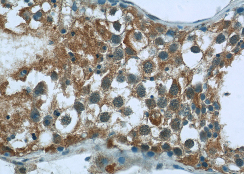 Immunohistochemistry of paraffin-embedded human testis tissue slide using Catalog No:108783(C6orf204 Antibody) at dilution of 1:50 (under 40x lens)