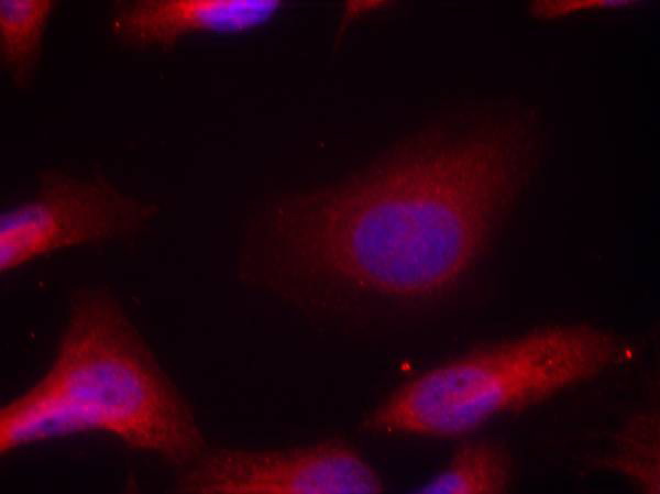 Immunofluorescence staining of methanol-fixed Hela cells using Src (Phospho-Tyr529) Antibody .