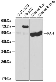 Western blot - PAH Polyclonal Antibody 