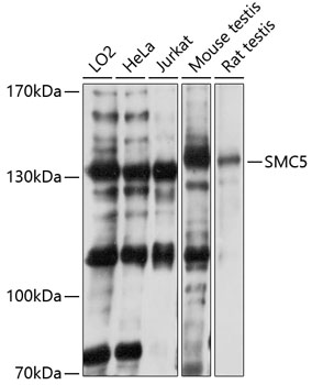 Western blot - SMC5 Polyclonal Antibody 