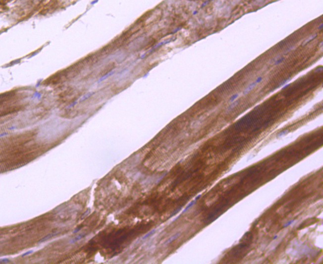 Fig2:; Immunohistochemical analysis of paraffin-embedded mouse skeletal muscle tissue using anti-Plectin antibody. The section was pre-treated using heat mediated antigen retrieval with Tris-EDTA buffer (pH 8.0-8.4) for 20 minutes.The tissues were blocked in 5% BSA for 30 minutes at room temperature, washed with ddH; 2; O and PBS, and then probed with the primary antibody ( 1/50) for 30 minutes at room temperature. The detection was performed using an HRP conjugated compact polymer system. DAB was used as the chromogen. Tissues were counterstained with hematoxylin and mounted with DPX.