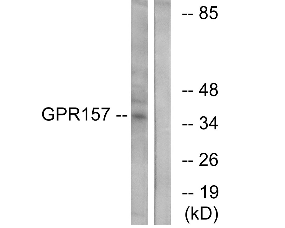 Fig2:; Western blot analysis of lysates from NIH/3T3 cells, using GPR157 Antibody. The lane on the right is blocked with the synthesized peptide.