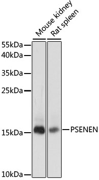 Western blot - PSENEN Polyclonal Antibody 