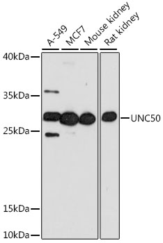 Western blot - UNC50 Polyclonal Antibody 