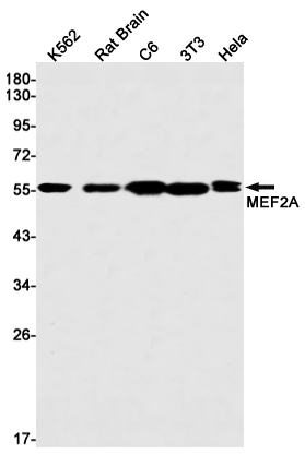 Western blot detection of MEF2A in K562,Rat Brain,C6,3T3,Hela cell lysates using MEF2A Rabbit mAb(1:1000 diluted).Predicted band size:55kDa.Observed band size:55kDa.