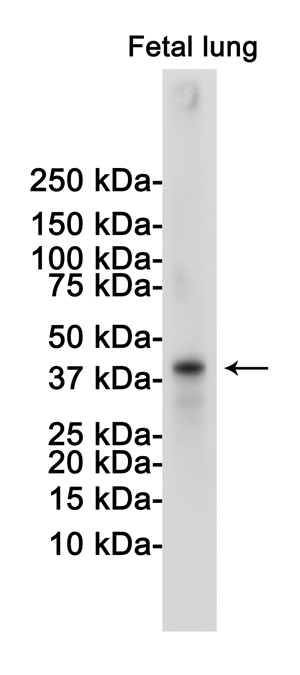 Western blot detection of TTF1 in Fetal lung lysates using TTF1 Rabbit pAb(1:1000 diluted).Predicted band size:39KDa.Observed band size:39KDa.