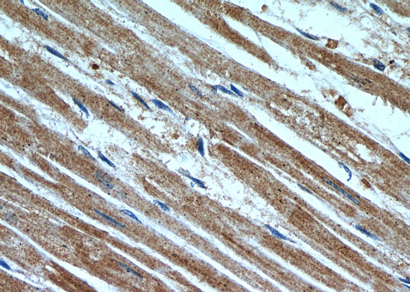 Immunohistochemistry of paraffin-embedded human heart slide using Catalog No:113243(NLRX1 Antibody) at dilution of 1:50