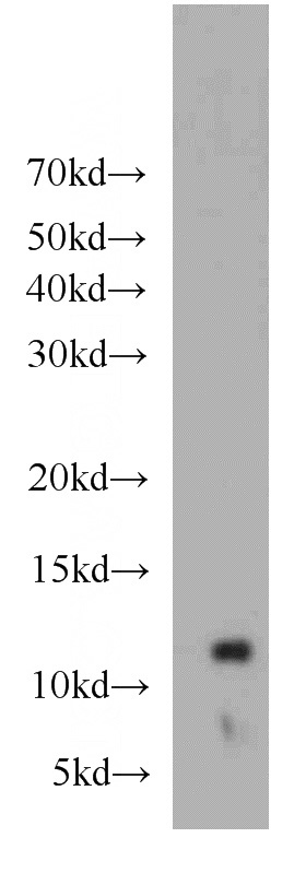 BxPC-3 cells were subjected to SDS PAGE followed by western blot with Catalog No:109402(CLPS antibody) at dilution of 1:200
