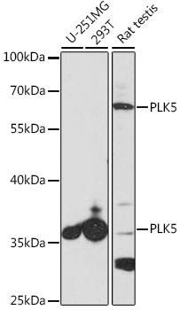 Western blot - PLK5 Polyclonal Antibody 