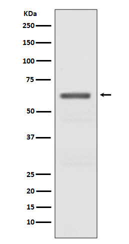 Western blot analysis of Phospho-AMPK alpha (T172) expression in Mouse heart lysate.