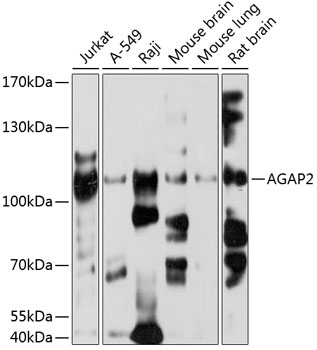 Western blot - AGAP2 Polyclonal Antibody 