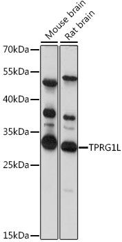Western blot - TPRG1L Polyclonal Antibody 