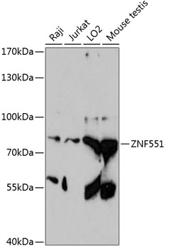 Western blot - ZNF551 Polyclonal Antibody 