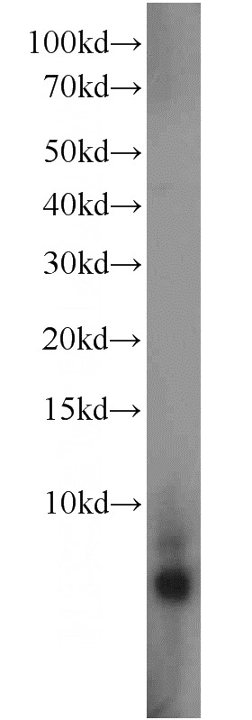 PC-3 cells were subjected to SDS PAGE followed by western blot with Catalog No:110923(GDEP antibody) at dilution of 1:1000