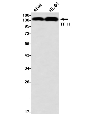 Western blot detection of TFII I in A549,HL-60 using TFII I Rabbit mAb(1:1000 diluted)