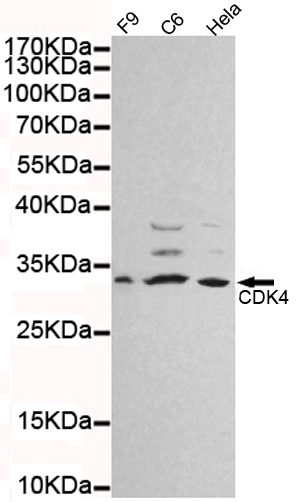 Western blot detection of CDK4 in Hela,C6 and F9 cell lysates using CDK4 mouse mAb (1:1000 diluted).Predicted band size:34KDa.Observed band size:34KDa.