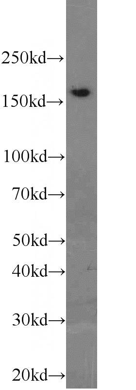K-562 cells were subjected to SDS PAGE followed by western blot with Catalog No:113703(PCF11 antibody) at dilution of 1:1000