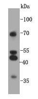Fig1: Western blot analysis on 293 cell lysates using anti-GPR132 rabbit polyclonal antibodies.